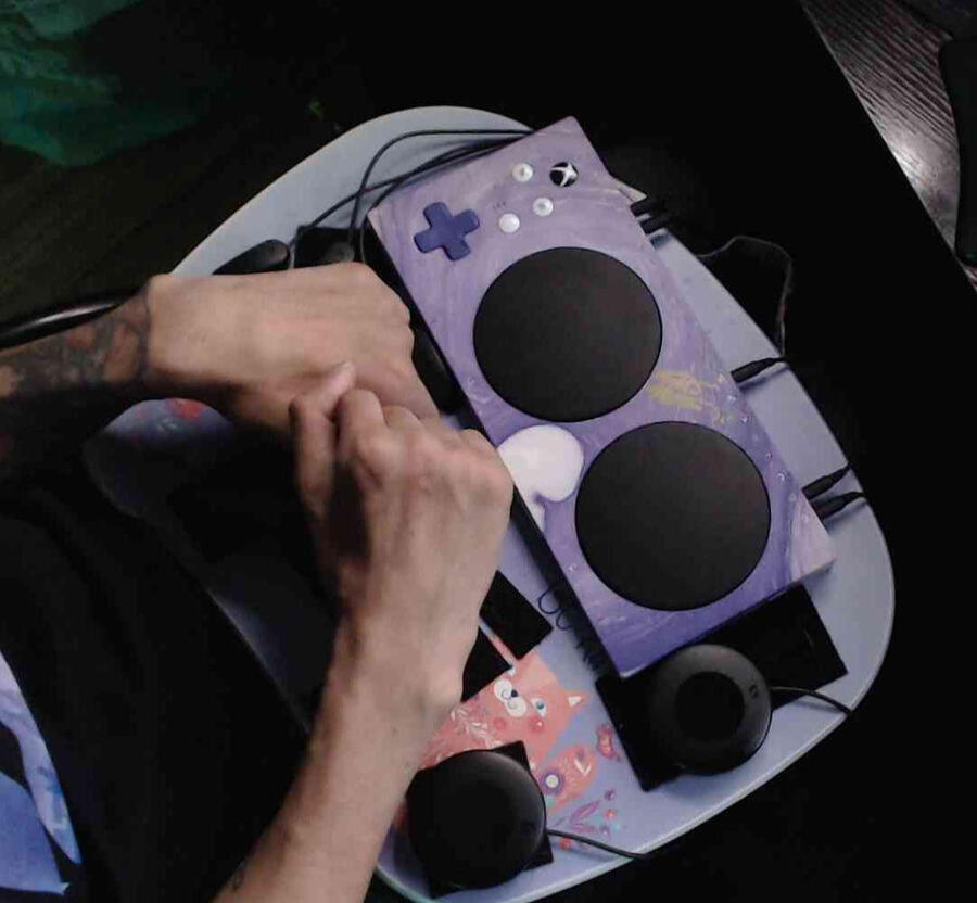 mike pictured in hospital bed with a neck brace after his accident